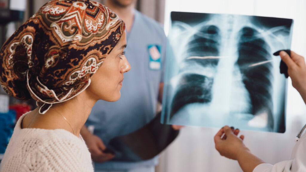 Breast Cancer mRNA vaccines